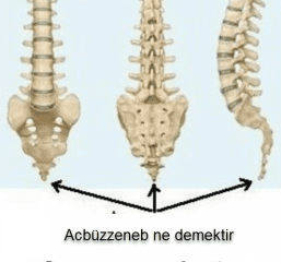 Acbuzzeneb ne demek