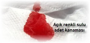 Acik renkli sulu adet kanamasi