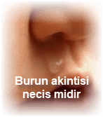 Burun akintisi necis midir