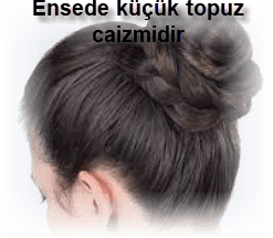 Ensede kucuk topuz caizmidir