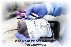 Kan Nakli Ve Sut Kardesin Yasaklanmasi