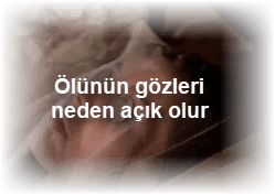 Olunun gozleri neden acik olur