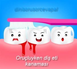 Orucluyken dis eti kanamasi