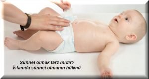 Sunnet olmak farz midir Islamda sunnet olmanin hukmu