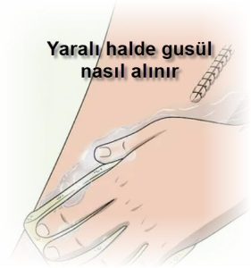 Yarali halde gusul nasil alinir