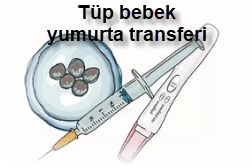 Tup bebek yumurta transferi