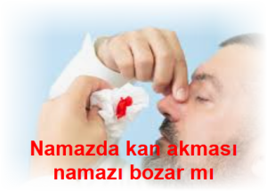 Namazda kan akmasi namazi bozar mi