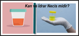 Kan ve Idrar necis midir