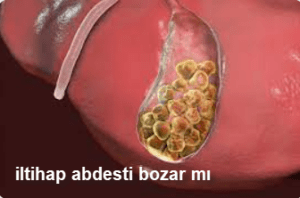 iltihap abdesti bozar mi