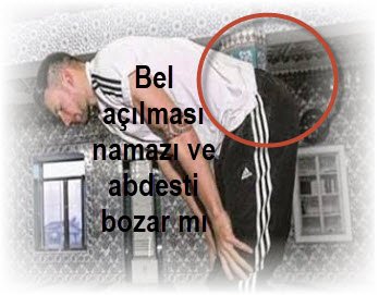 Bel acilmasi namazi ve abdesti bozar mi